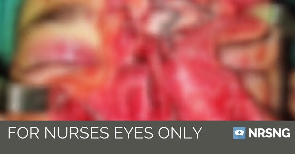 Disgusting medical pictures