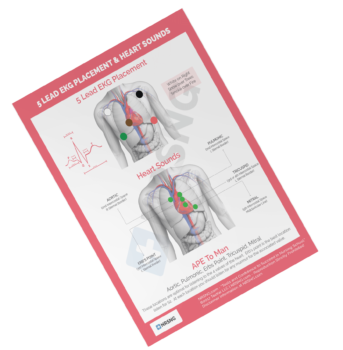 ekg placement cheatsheet
