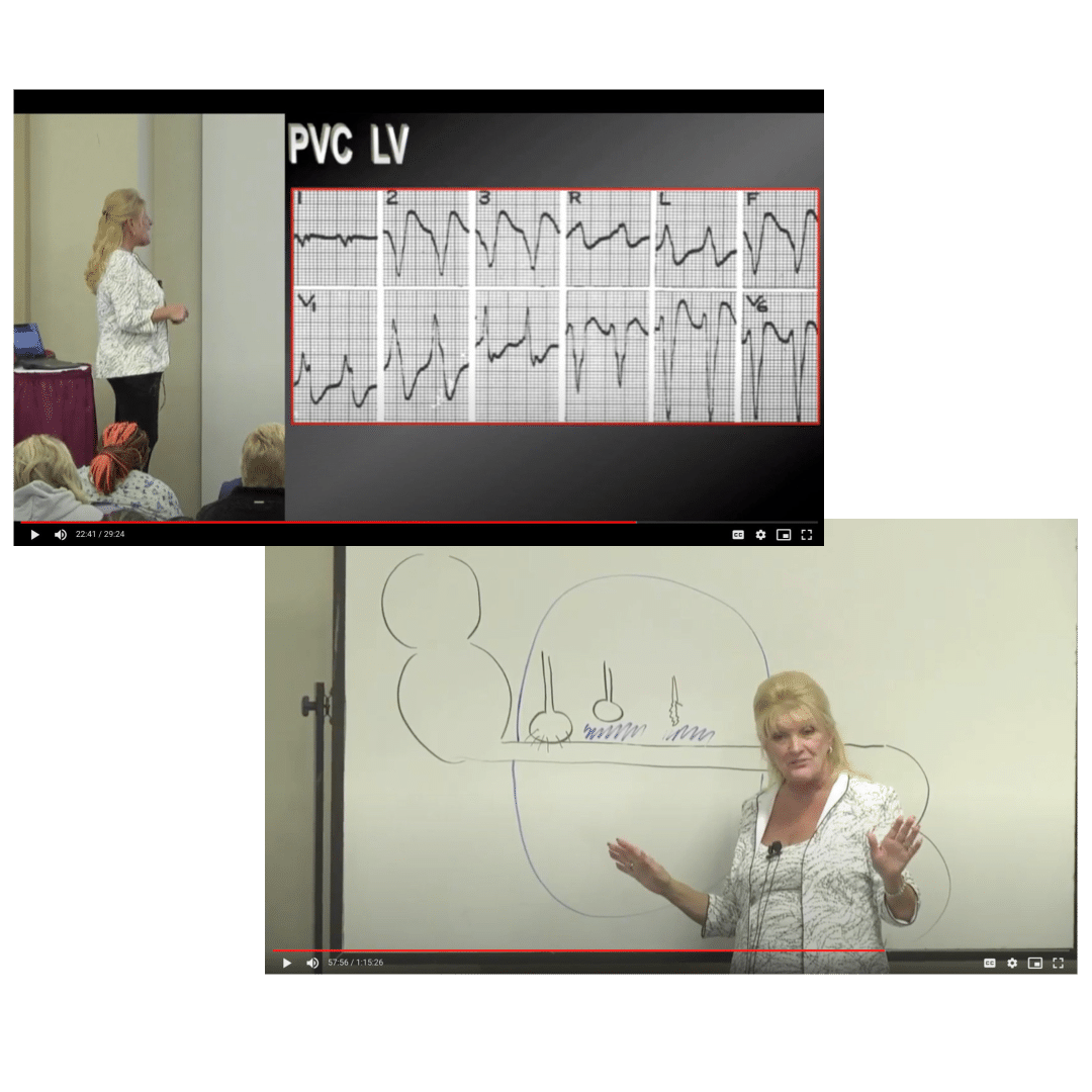 laura gasparis videos