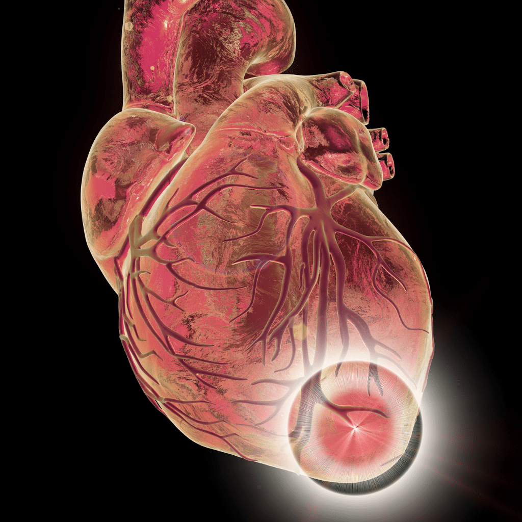 nursing intervention for chest pain