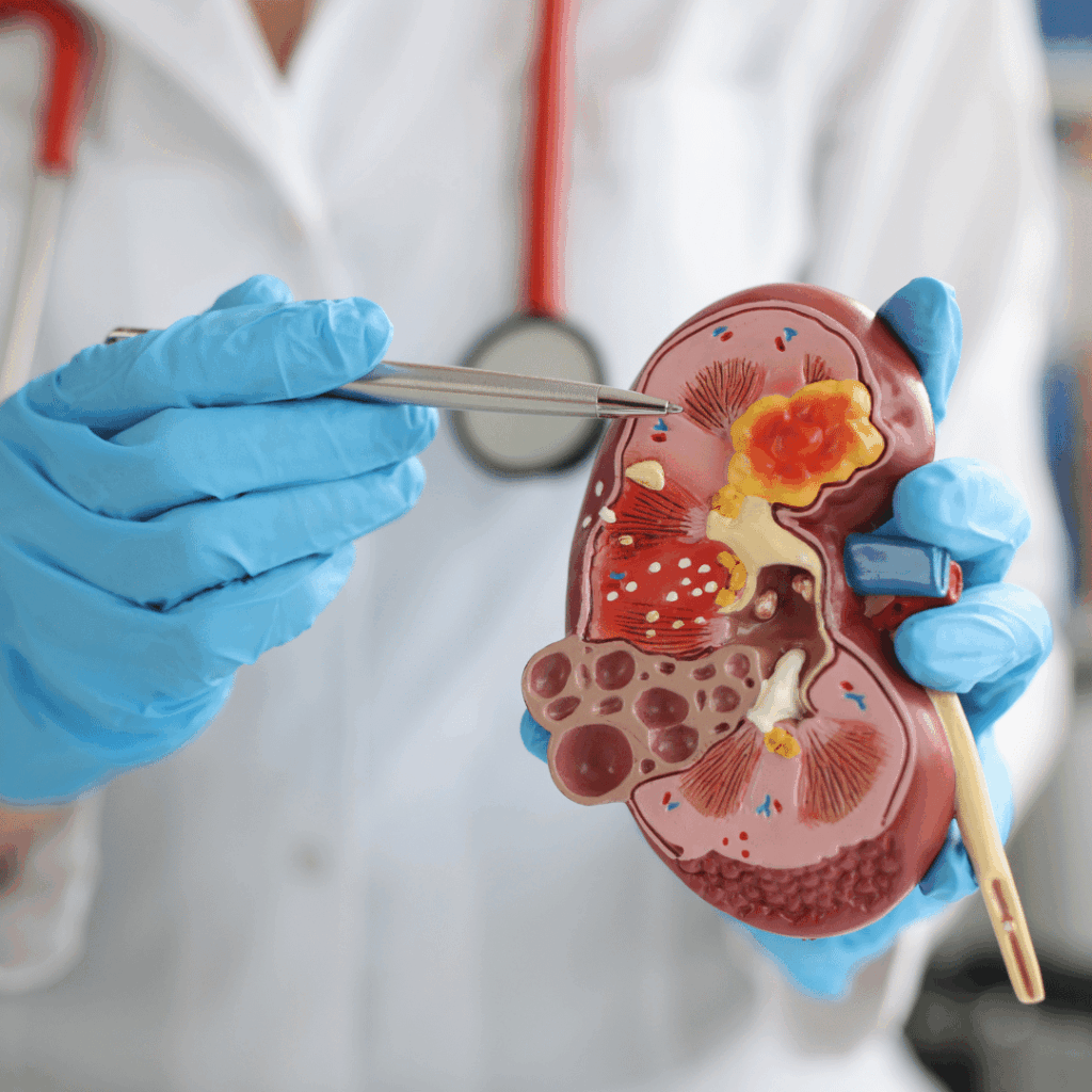nclex prep for addisons disease