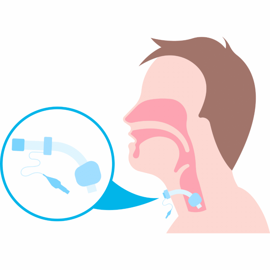 nclex prep Artificial Airways