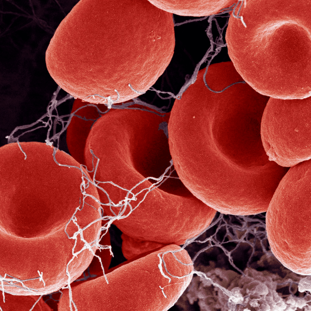 Disseminated Intravascular Coagulation (DIC) nclex prep review