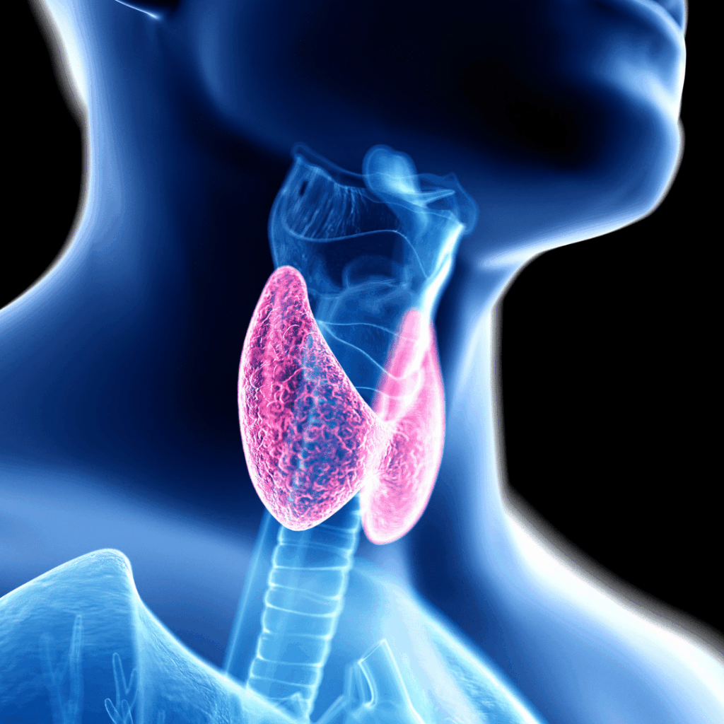 nclex prep hypothyroidism