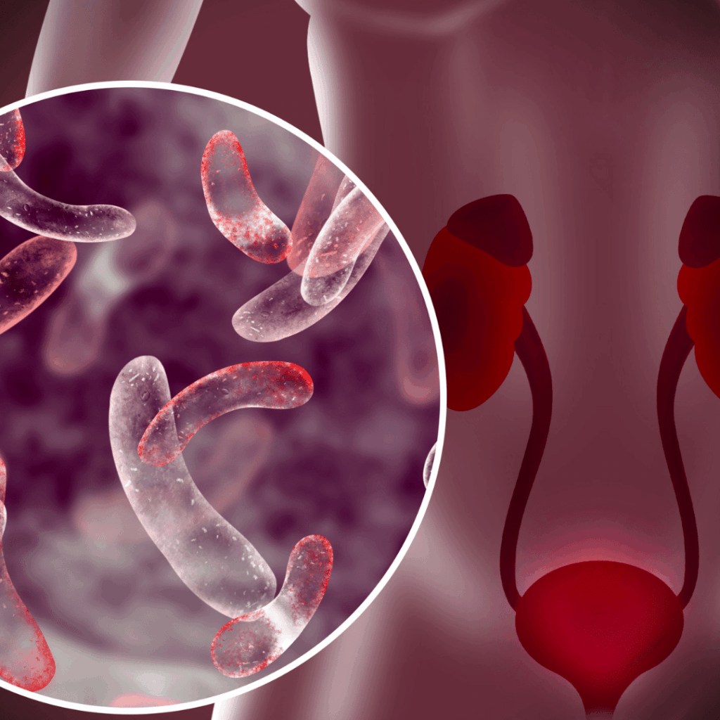 Urinary tract infection (UTI) nclex prep review