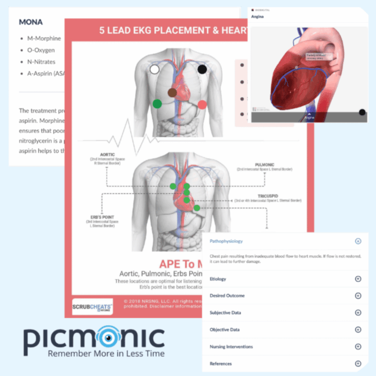NURSING.com offers a vast array of study tools including cheatsheets, picmonics, mnemonics, medical images and more to help nursing students succeed. NURSING.com vs Uworld..
