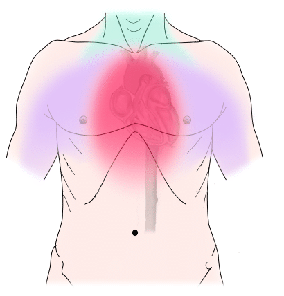 nursing.com angina lesson for nursing students