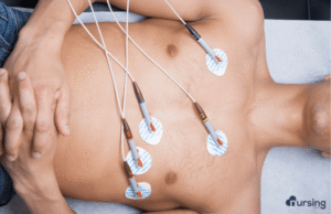 EKG leads, for patient with angina