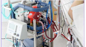 ecmo machine for gas exchange